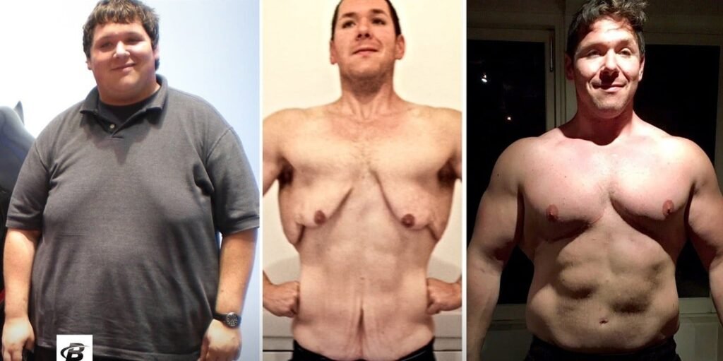 Loose-Skin-After-Weight-Loss.jpg